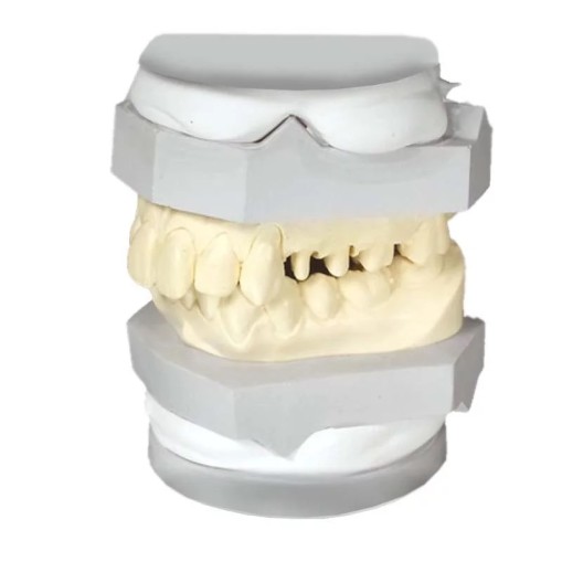 Gips articulator SheraArti-Quick white 20kg Shera