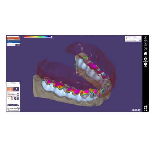 Modul exocad Bite splint