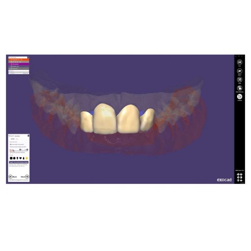 Modul exocad Provisional